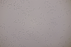 Botryobasidium subcoronatum