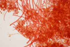 Botryobasidium subcoronatum