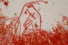 Botryobasidium subcoronatum