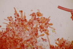 Botryobasidium subcoronatum