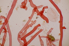 Botryobasidium subcoronatum