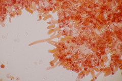 Botryobasidium subcoronatum