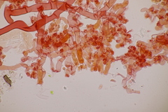 Botryobasidium subcoronatum