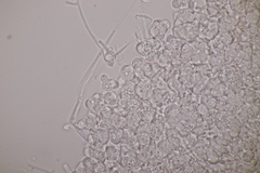 Hypomyces