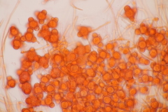 Hypomyces