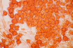 Hypomyces