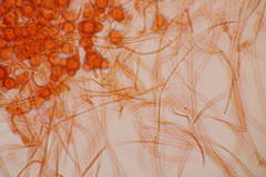Hypomyces