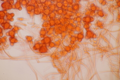 Hypomyces