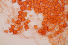 Hypomyces