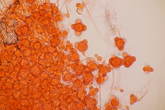 Hypomyces
