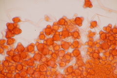 Hypomyces