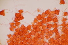 Hypomyces