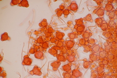 Hypomyces