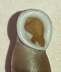 Carinigera lophauchena