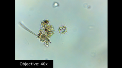 Amoebozoa