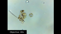 Amoebozoa