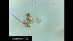 Amoebozoa