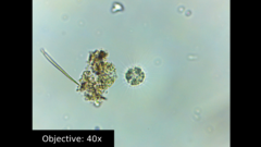 Amoebozoa