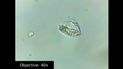 Amoebozoa