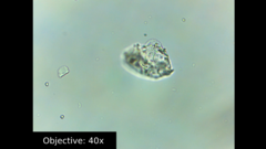 Amoebozoa