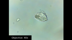 Amoebozoa
