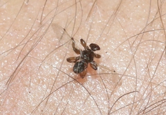 Lipoptena depressa