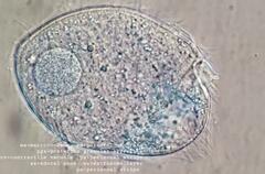 Brachonella contorta