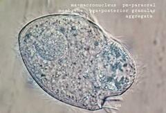 Brachonella contorta