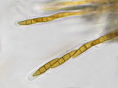 Leptosphaeria doliolum