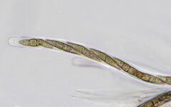 Leptosphaeria doliolum