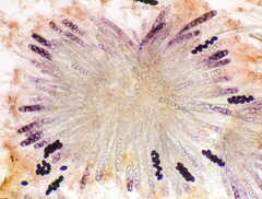 Ascobolus carbonarius