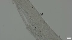 Strobilurus stephanocystis