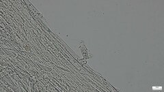 Strobilurus stephanocystis