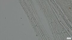 Strobilurus stephanocystis