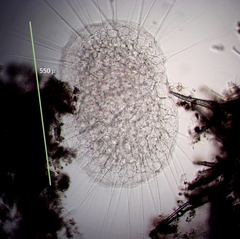 Actinosphaerium