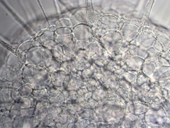 Actinosphaerium
