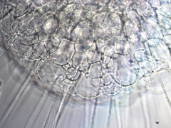 Actinosphaerium