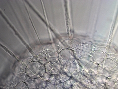 Actinosphaerium