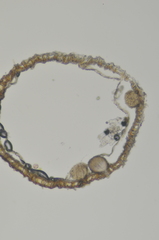 Dothideomycetes
