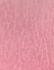 Dasya spinuligera