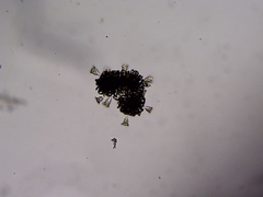 Dolichospermum lemmermannii