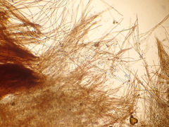 Chaetocalathus cocciformis