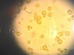 Chlorella