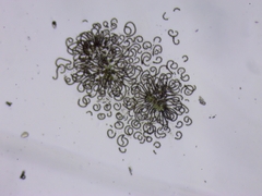 Dolichospermum lemmermannii