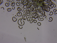 Dolichospermum lemmermannii