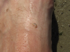 Crustacea