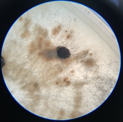 Sclerotinia sclerotiorum