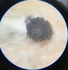 Sclerotinia sclerotiorum