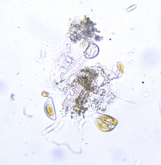 Encyonema