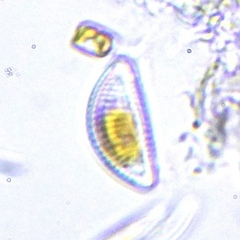 Encyonema